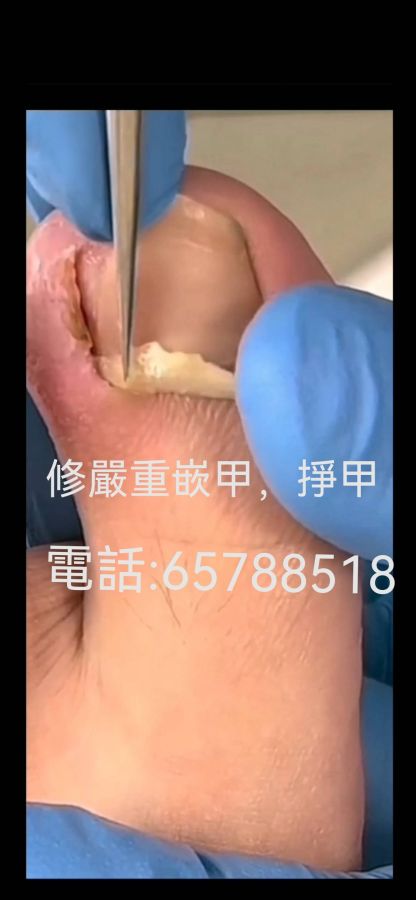 香港全師傅專業上海修甲